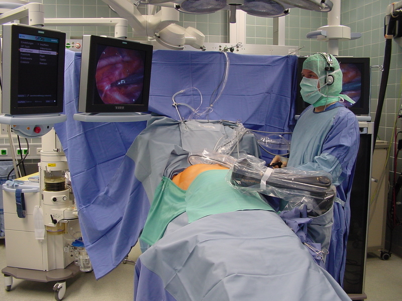 minimalinvasive Operation - Endoskopische transthorakale Sympathektomie